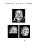 GENERATING MODEL DATA REPRESENTING A BIOLOGICAL BODY SECTION diagram and image