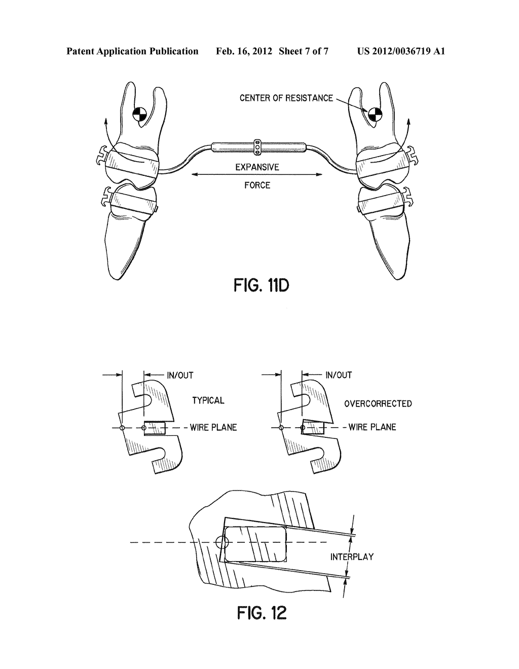 Torque Overcorrection Model - diagram, schematic, and image 08