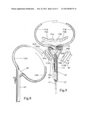 Mechanical device for securing and pulling people in peril to safety diagram and image