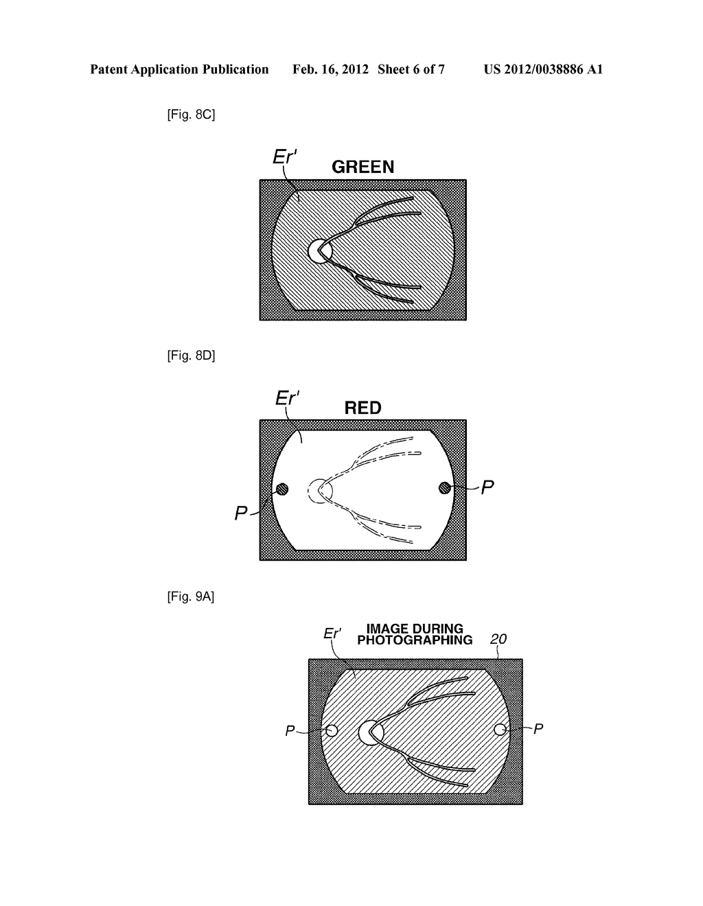 OPHTHALMOLOGIC OBSERVATION AND PHOTOGRAPHING APPARATUS - diagram, schematic, and image 07