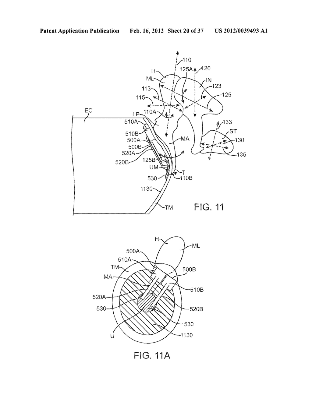 TRANSDUCER DEVICES AND METHODS FOR HEARING - diagram, schematic, and image 21