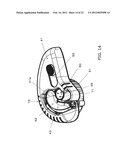 AUXILIARY MEMBER FOR HEARING AID diagram and image