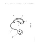 AUXILIARY MEMBER FOR HEARING AID diagram and image