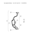 AUXILIARY MEMBER FOR HEARING AID diagram and image