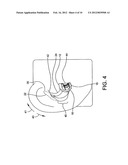 Earpiece Positioning and Retaining diagram and image