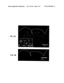 Nanoparticle Targeted Drug Delivery to the Lungs Using Extra-Testicular     Sertoli Cells diagram and image