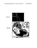 Nanoparticle Targeted Drug Delivery to the Lungs Using Extra-Testicular     Sertoli Cells diagram and image