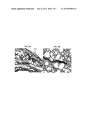 Nanoparticle Targeted Drug Delivery to the Lungs Using Extra-Testicular     Sertoli Cells diagram and image