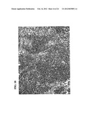 A34 AND A33-LIKE 3 DNA PROTEIN, ANTIBODIES THERETO AND METHODS OF     TREATMENT USING SAME diagram and image