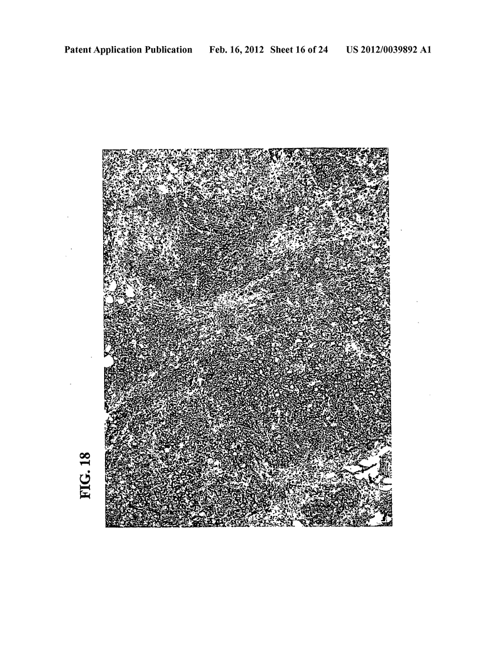 A34 AND A33-LIKE 3 DNA PROTEIN, ANTIBODIES THERETO AND METHODS OF     TREATMENT USING SAME - diagram, schematic, and image 17