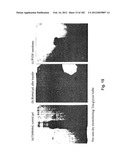 METHOD OF TREATMENT OF NEURODEMENTING DISEASES USING ISOLATED, MONOCLONAL,     HUMAN, ANTI-B-AMYLOID ANTIBODY diagram and image