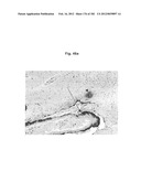 METHOD OF TREATMENT OF NEURODEMENTING DISEASES USING ISOLATED, MONOCLONAL,     HUMAN, ANTI-B-AMYLOID ANTIBODY diagram and image