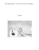 METHOD OF TREATMENT OF NEURODEMENTING DISEASES USING ISOLATED, MONOCLONAL,     HUMAN, ANTI-B-AMYLOID ANTIBODY diagram and image