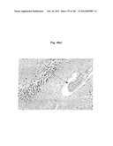 METHOD OF TREATMENT OF NEURODEMENTING DISEASES USING ISOLATED, MONOCLONAL,     HUMAN, ANTI-B-AMYLOID ANTIBODY diagram and image