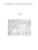 METHOD OF TREATMENT OF NEURODEMENTING DISEASES USING ISOLATED, MONOCLONAL,     HUMAN, ANTI-B-AMYLOID ANTIBODY diagram and image