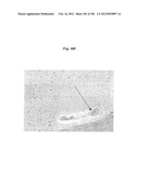 METHOD OF TREATMENT OF NEURODEMENTING DISEASES USING ISOLATED, MONOCLONAL,     HUMAN, ANTI-B-AMYLOID ANTIBODY diagram and image