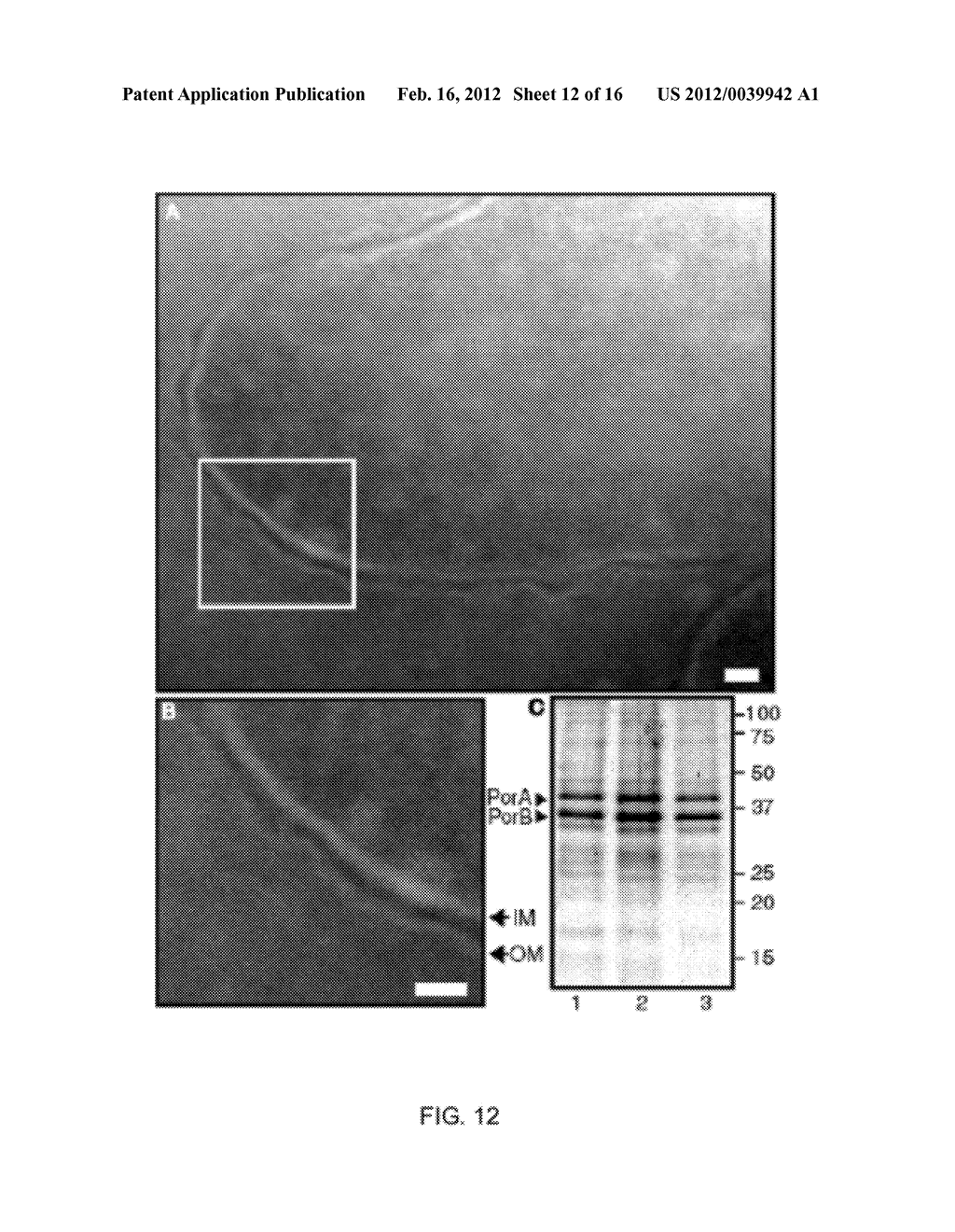 OUTER MEMBRANE VESICLES AND USES THEREOF - diagram, schematic, and image 13