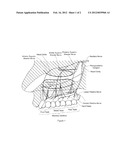 DENTAL ANESTHETIC COMPRISING TETRACAINE AND A VASOCONSTRICTOR FOR     INTRANASAL ADMINISTRATION diagram and image