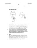 DENTAL ANESTHETIC COMPRISING TETRACAINE AND A VASOCONSTRICTOR FOR     INTRANASAL ADMINISTRATION diagram and image