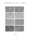 TREATMENT OF RADIATION-INDUCED FIBROSIS diagram and image