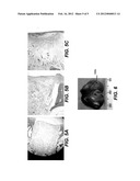 Regenerative Tissue Scaffolds diagram and image