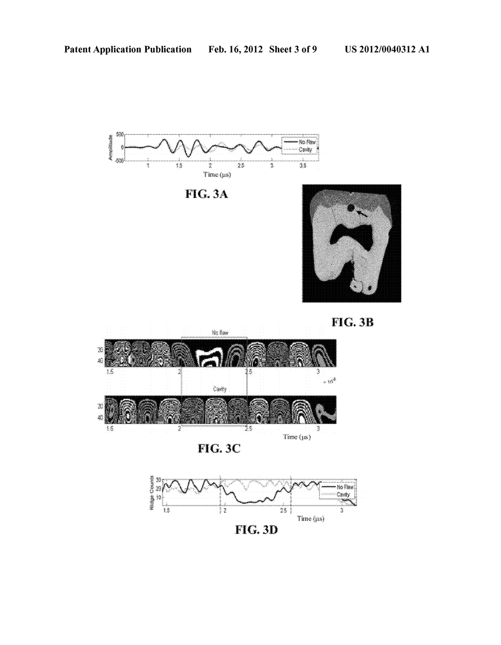 Dental Ultrasonography - diagram, schematic, and image 04