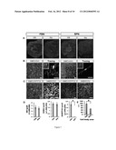 Directed Differentiation of Primate Pluripotent Stem Cells Into Functional     Basal Forebrain Cholinergic Neurons (BFCNs) and Medium Spiny Gabaergic     Projection Neurons diagram and image