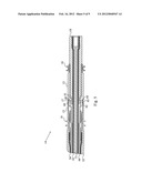 IMPLANTABLE ELECTRIC LEAD diagram and image