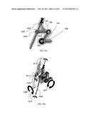 TWO-PART ENDOSCOPE SURGICAL DEVICE diagram and image