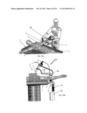 TWO-PART ENDOSCOPE SURGICAL DEVICE diagram and image