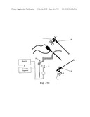 TWO-PART ENDOSCOPE SURGICAL DEVICE diagram and image