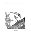 TWO-PART ENDOSCOPE SURGICAL DEVICE diagram and image