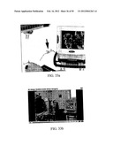 TWO-PART ENDOSCOPE SURGICAL DEVICE diagram and image