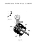 TWO-PART ENDOSCOPE SURGICAL DEVICE diagram and image