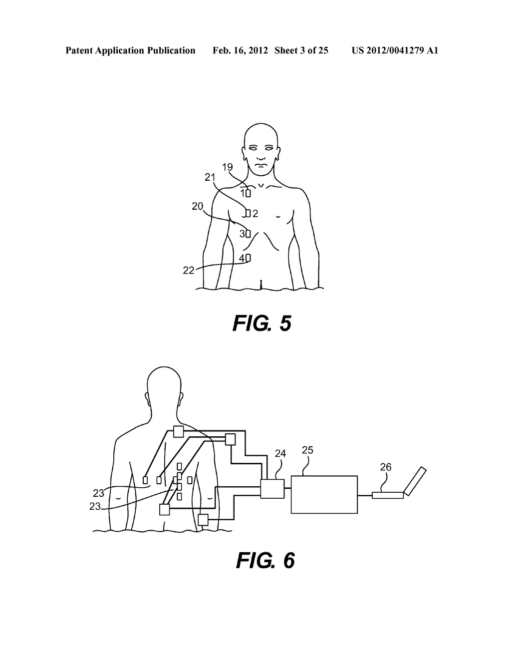 DEVICES AND METHODS FOR RESPIRATORY VARIATION MONITORING BY MEASUREMENT OF     RESPIRATORY VOLUMES, MOTION AND VARIABILITY - diagram, schematic, and image 04