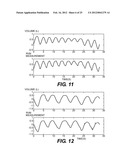 DEVICES AND METHODS FOR RESPIRATORY VARIATION MONITORING BY MEASUREMENT OF     RESPIRATORY VOLUMES, MOTION AND VARIABILITY diagram and image