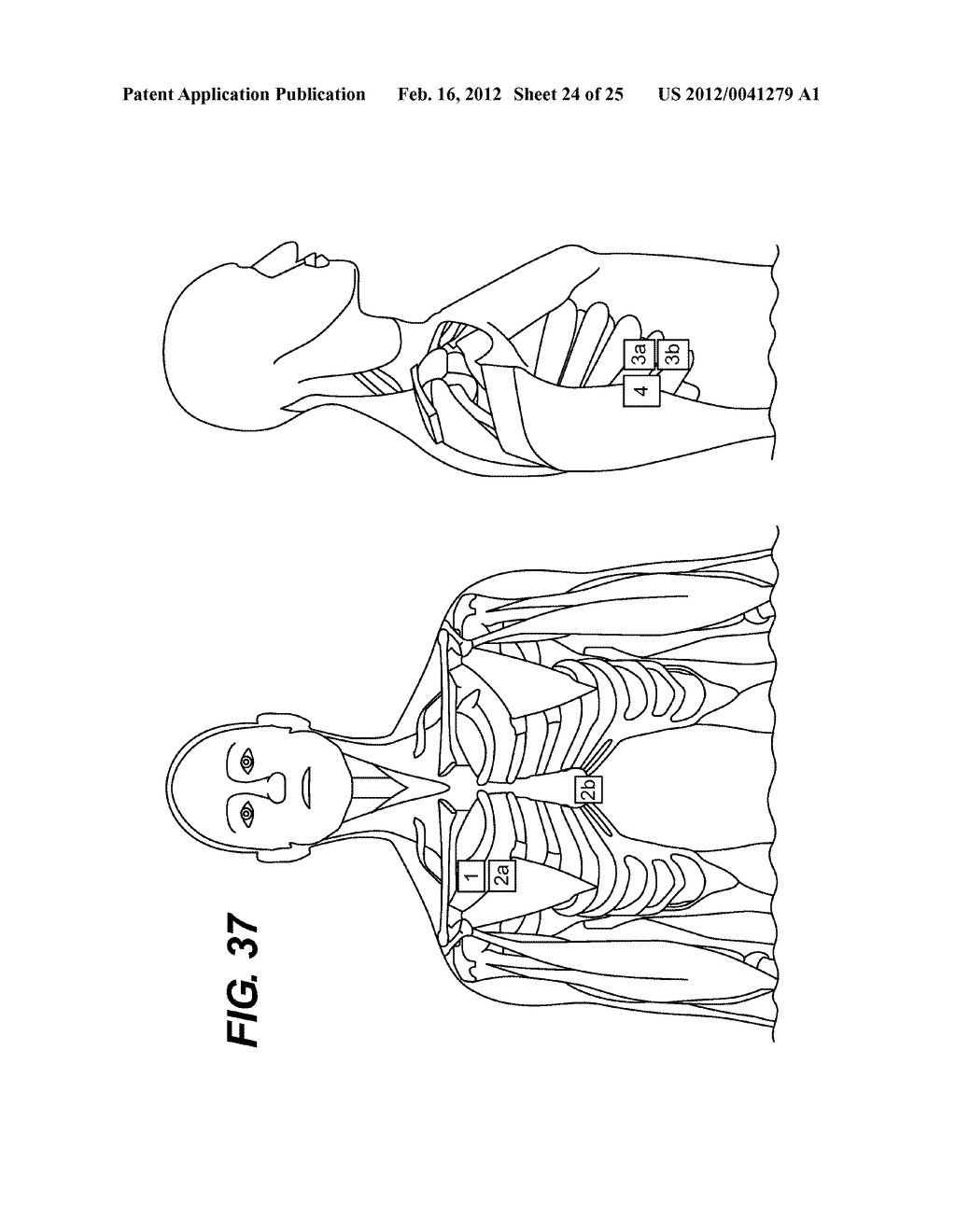 DEVICES AND METHODS FOR RESPIRATORY VARIATION MONITORING BY MEASUREMENT OF     RESPIRATORY VOLUMES, MOTION AND VARIABILITY - diagram, schematic, and image 25