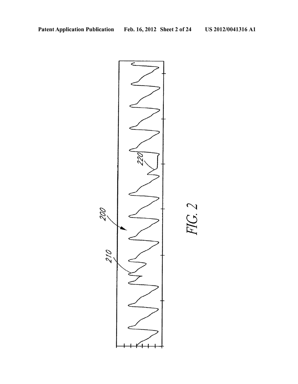 PULSE AND CONFIDENCE INDICATOR DISPLAYED PROXIMATE PLETHYSMOGRAPH - diagram, schematic, and image 03