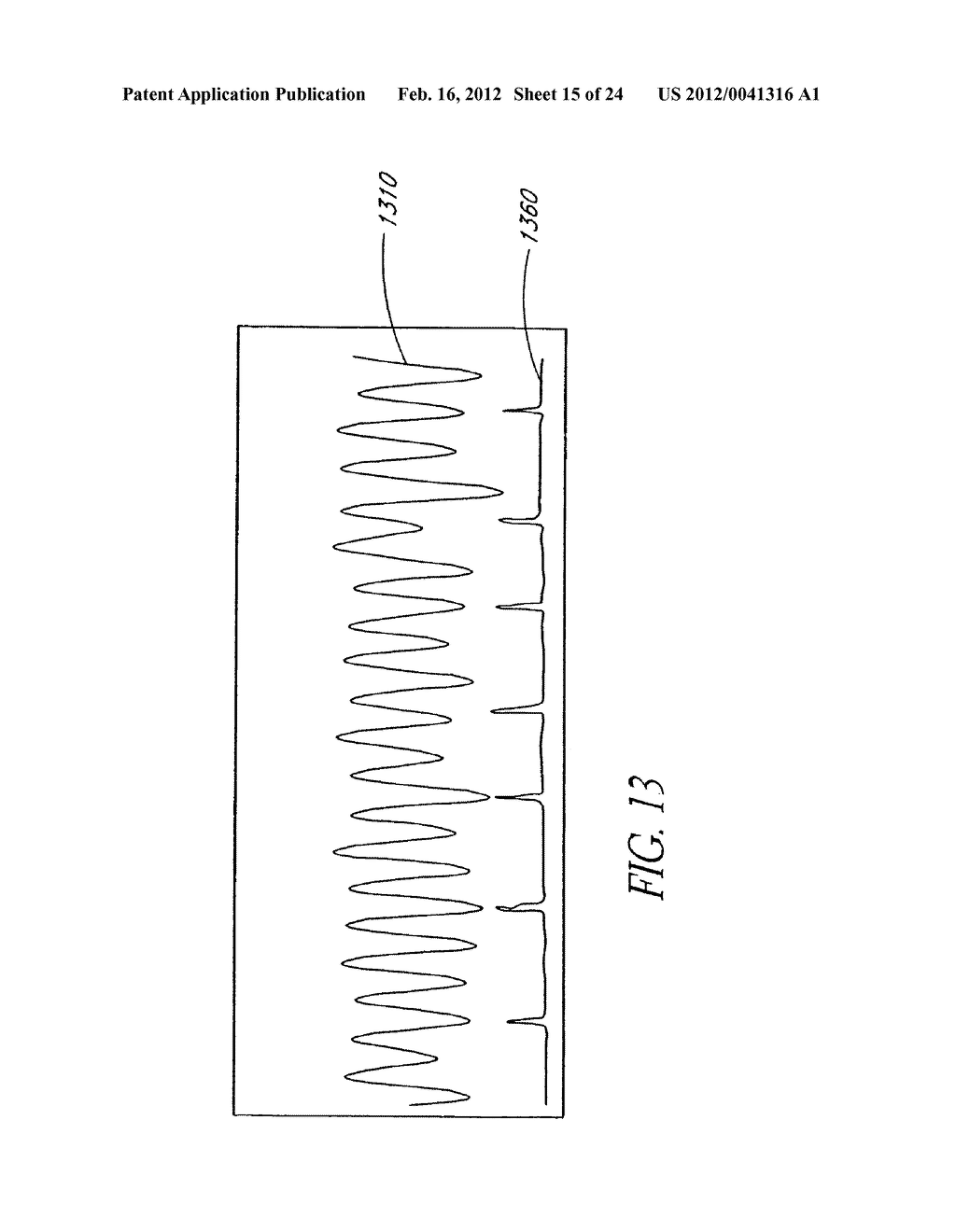 PULSE AND CONFIDENCE INDICATOR DISPLAYED PROXIMATE PLETHYSMOGRAPH - diagram, schematic, and image 16