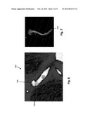 METHOD AND SYSTEM FOR PATIENT-SPECIFIC MODELING OF BLOOD FLOW diagram and image