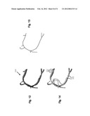 METHOD AND SYSTEM FOR PATIENT-SPECIFIC MODELING OF BLOOD FLOW diagram and image