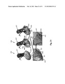 METHOD AND SYSTEM FOR PATIENT-SPECIFIC MODELING OF BLOOD FLOW diagram and image