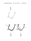 METHOD AND SYSTEM FOR PATIENT-SPECIFIC MODELING OF BLOOD FLOW diagram and image