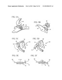 ADAPTABLE BREATHING MASK diagram and image