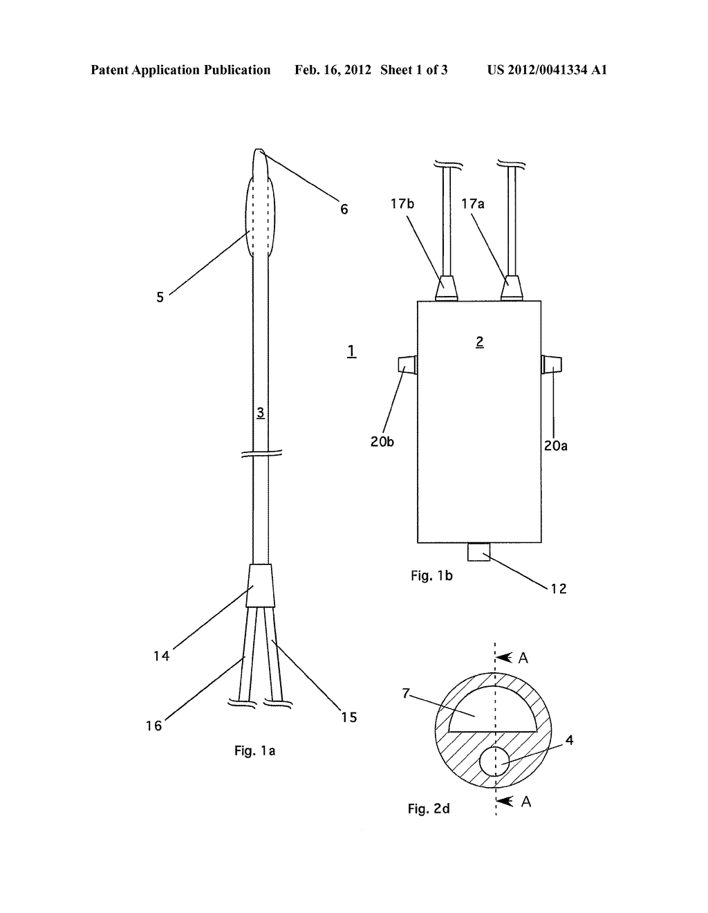 DEVICE FOR MEASURING THE BLADDER PRESSURE - diagram, schematic, and image 02