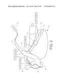 SHOULDER STABILIZING ORTHOTIC diagram and image