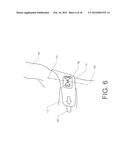 SHOULDER STABILIZING ORTHOTIC diagram and image