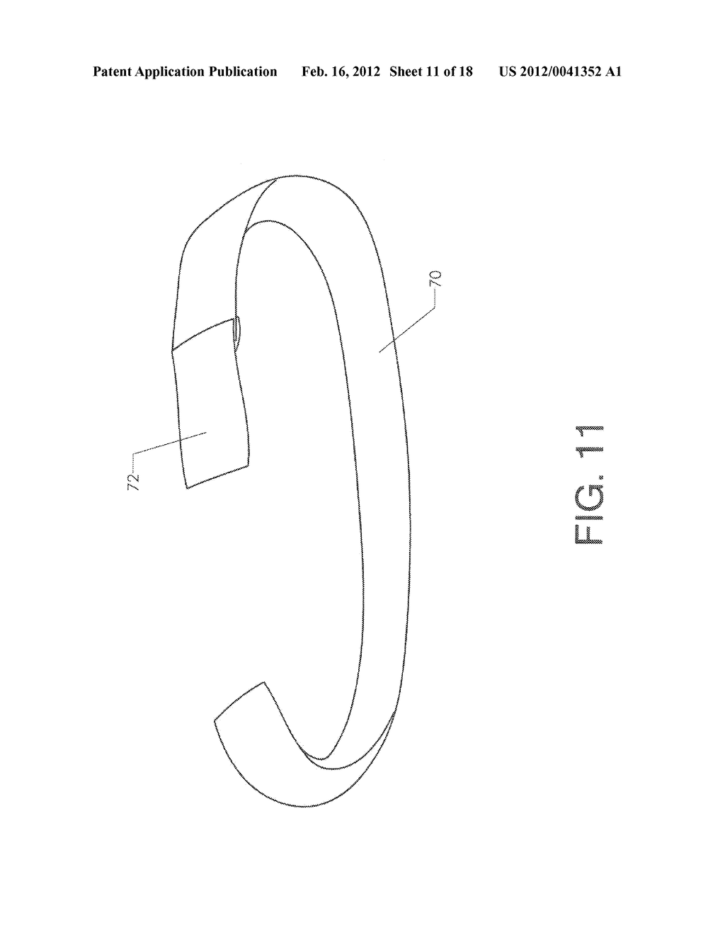 SHOULDER STABILIZING ORTHOTIC - diagram, schematic, and image 12