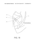 SHOULDER STABILIZING ORTHOTIC diagram and image