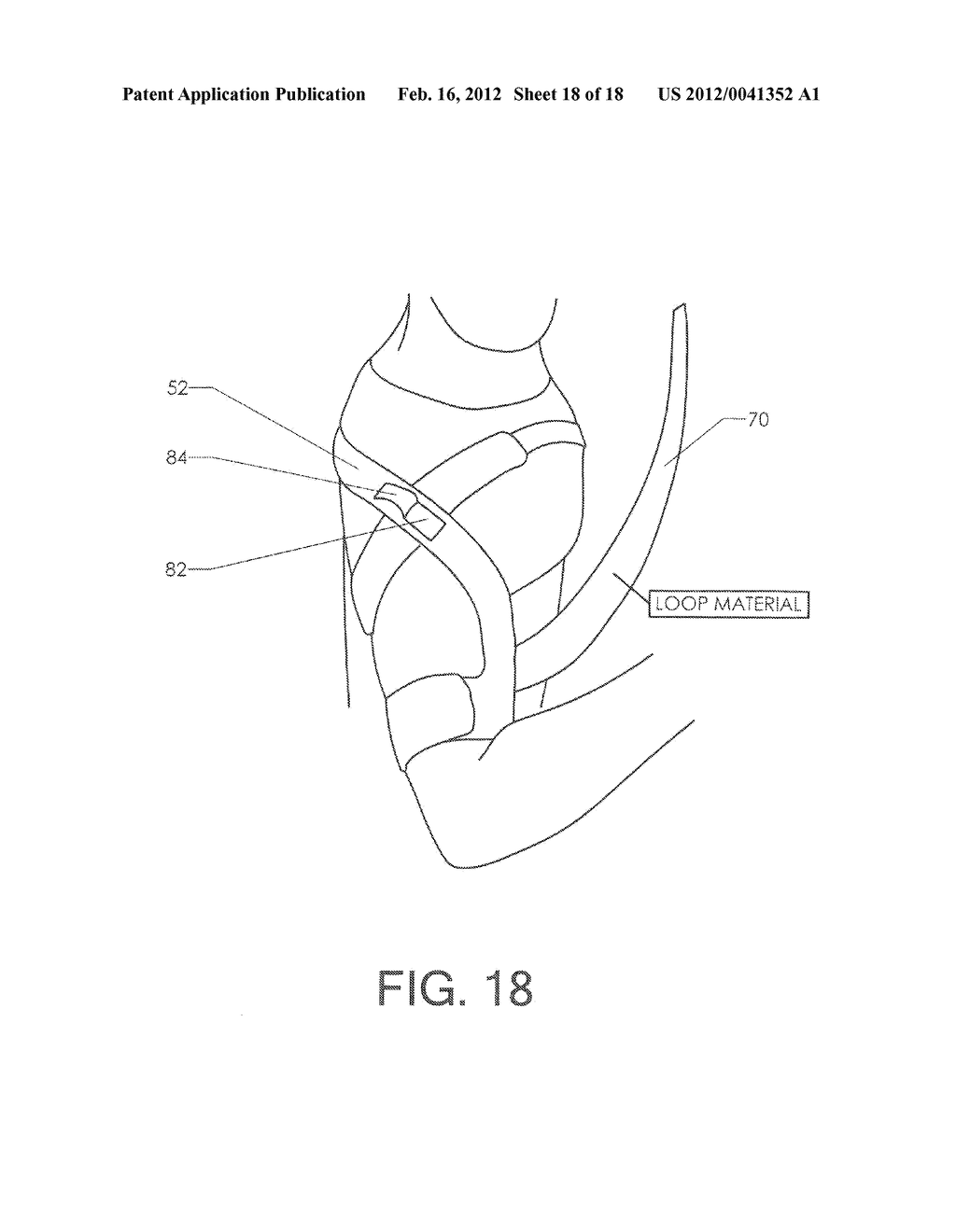 SHOULDER STABILIZING ORTHOTIC - diagram, schematic, and image 19